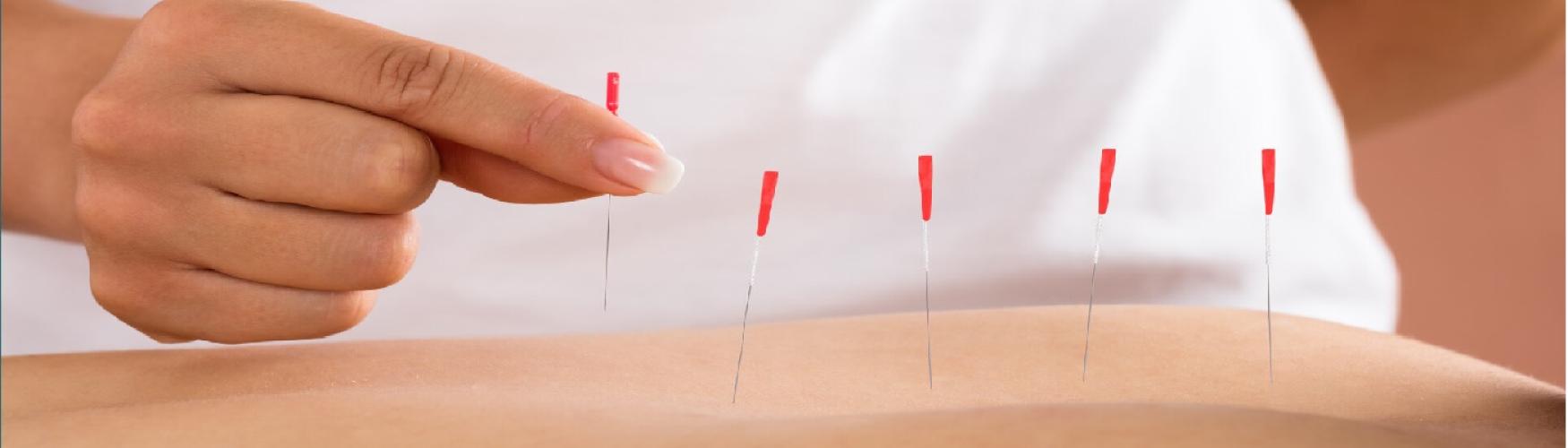 Royal Oak physio