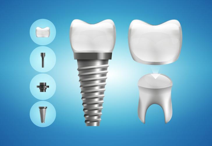 Emergency Dentist Houston