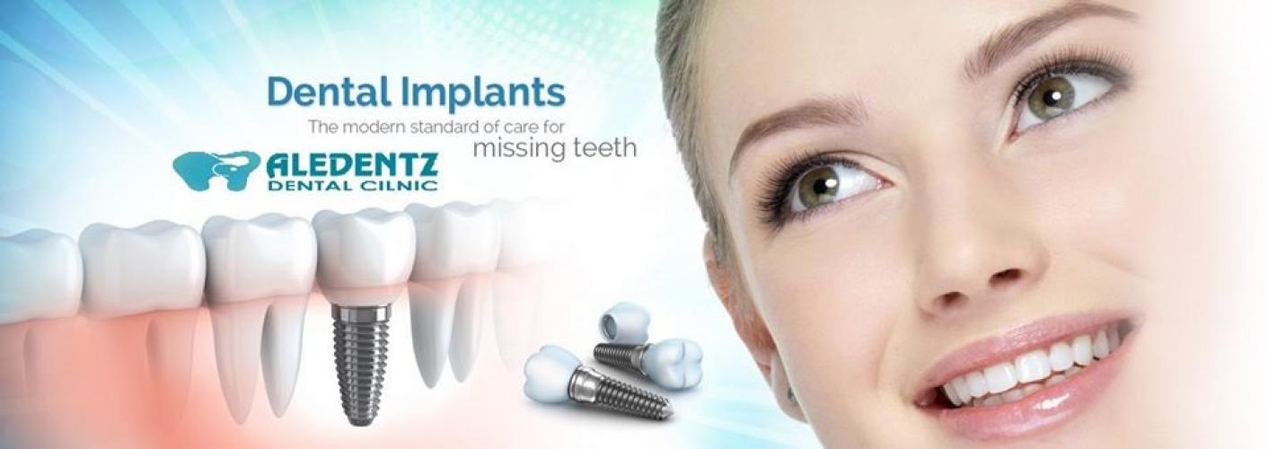 Aledentz Dental Implant & Orthodontic Center-Uttam Nagar