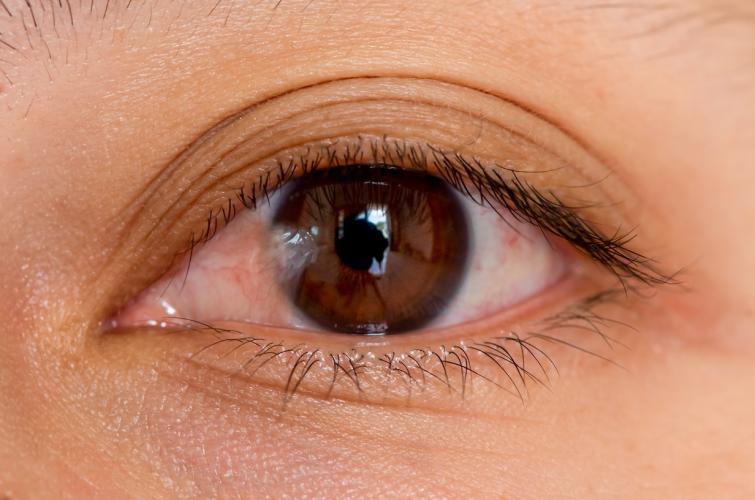 ouston Lasik & Eye