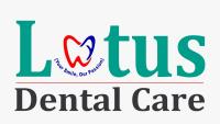 Lotus Dental Care and Implant Centre | Dental Implant | Smile Designing Clinic in Kalyan